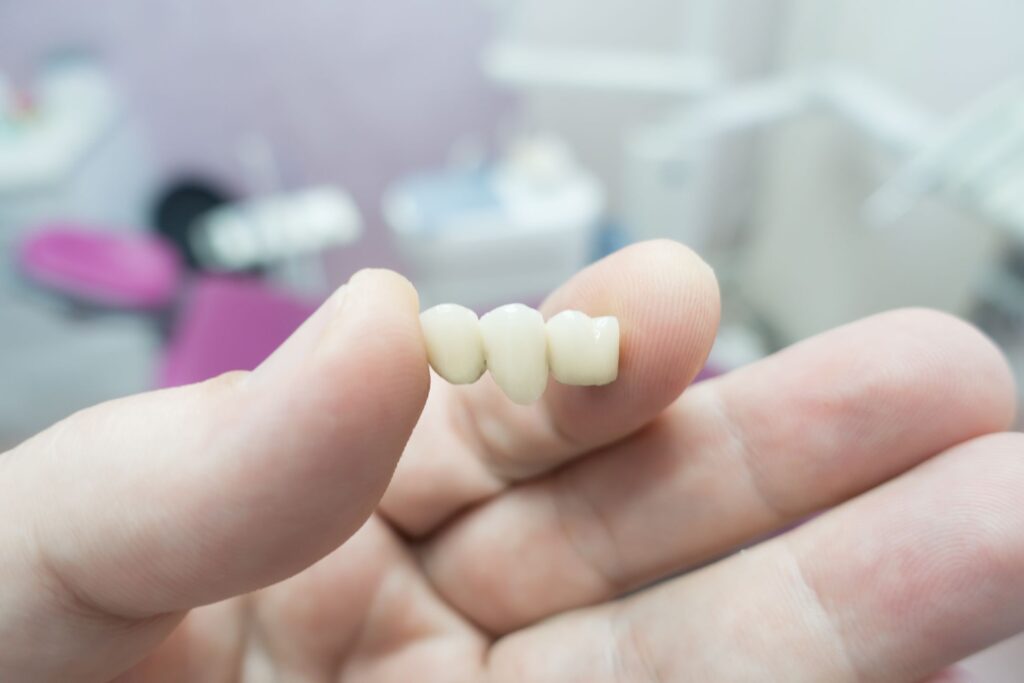 Hand holding a dental bridge that has fallen out